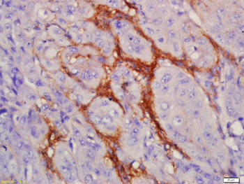 EGFRvIII Rabbit Polyclonal Antibody
