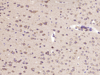 IL-11 Rabbit Polyclonal Antibody