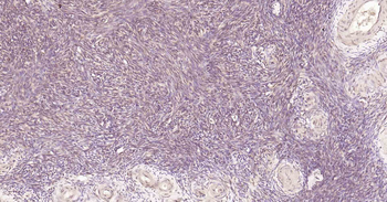 MTNR1B Rabbit Polyclonal Antibody