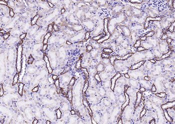EMP-1 Rabbit Polyclonal Antibody