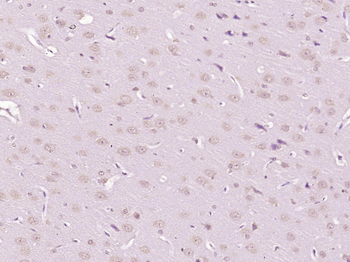 GDNF Rabbit Polyclonal Antibody