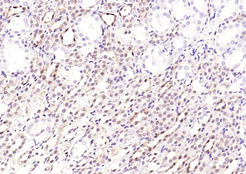STAT3 Mouse Monoclonal Antibody