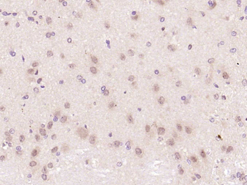 SOX2 Rabbit Polyclonal Antibody