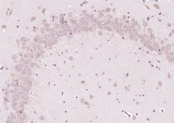 CDK5 Rabbit Polyclonal Antibody