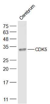 CDK5 Rabbit Polyclonal Antibody