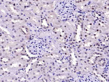 FAK Rabbit Polyclonal Antibody