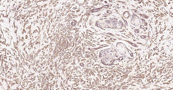DDIT3 Rabbit Polyclonal Antibody