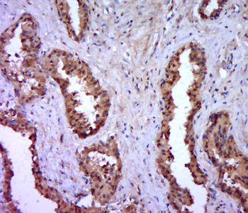 Phospho-BRCA1 (Ser1466) Rabbit Polyclonal Antibody