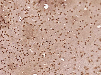 Anillin Rabbit Polyclonal Antibody