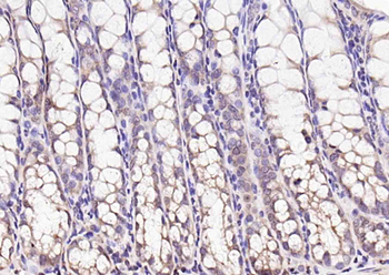 Anillin Rabbit Polyclonal Antibody