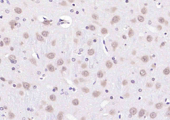 Anillin Rabbit Polyclonal Antibody