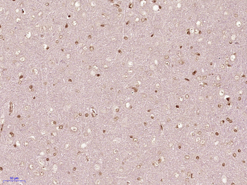 Nucleophosmin Rabbit Polyclonal Antibody