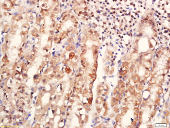 Notch1 Rabbit Polyclonal Antibody
