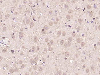 Notch1 Rabbit Polyclonal Antibody