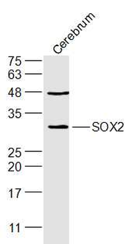 SOX2 Rabbit Polyclonal Antibody