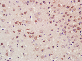 Nrf2 Rabbit Polyclonal Antibody