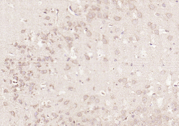 Nrf2 Rabbit Polyclonal Antibody