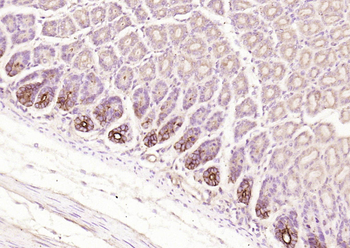 Nrf2 Rabbit Polyclonal Antibody