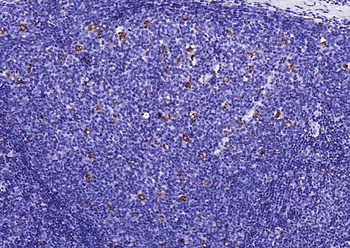 CD68 Rabbit Polyclonal Antibody