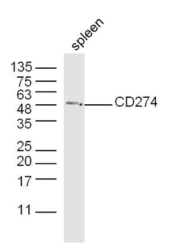 PD-L1 Rabbit Polyclonal Antibody