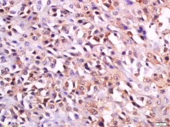 MC1R Rabbit Polyclonal Antibody