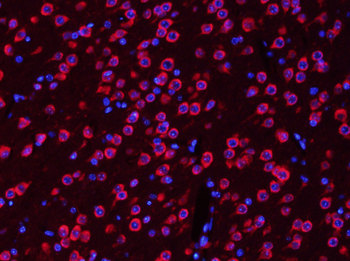 TUBB3 (Neuronal Marker) Rabbit Polyclonal Antibody
