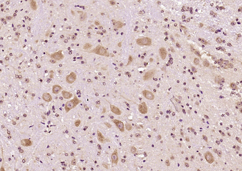 TUBB3 (Neuronal Marker) Rabbit Polyclonal Antibody
