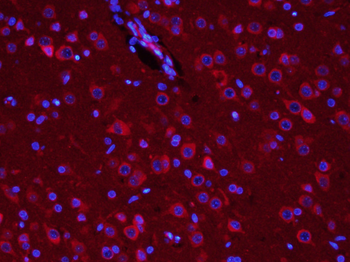 TUBB3 (Neuronal Marker) Rabbit Polyclonal Antibody