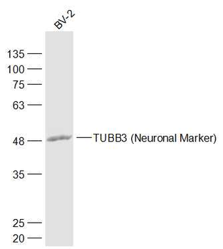 TUBB3 (Neuronal Marker) Rabbit Polyclonal Antibody