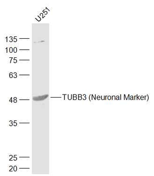 TUBB3 (Neuronal Marker) Rabbit Polyclonal Antibody
