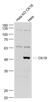 CK18 Rabbit Polyclonal Antibody