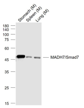 SMAD7 Rabbit Polyclonal Antibody