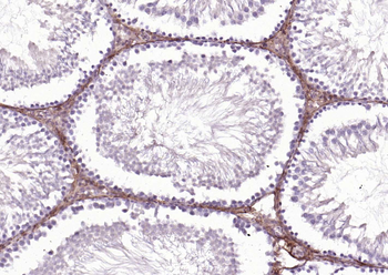 CD34 Rabbit Polyclonal Antibody