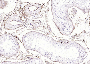 CD34 Rabbit Polyclonal Antibody