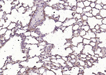 CD34 Rabbit Polyclonal Antibody