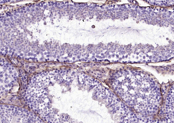CD34 Rabbit Polyclonal Antibody