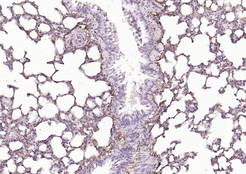 CD34 Rabbit Polyclonal Antibody