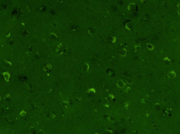 TIMP-1 Mouse Monoclonal Antibody