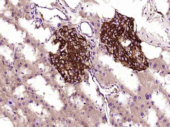 TIMP-1 Mouse Monoclonal Antibody