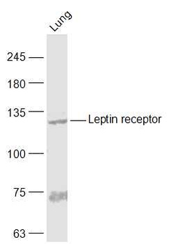 Leptin Receptor antibody