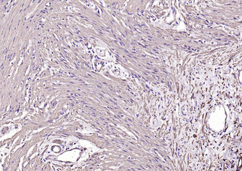 Alpha smooth muscle Actin Mouse Monoclonal Antibody