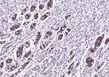 Bax Mouse Monoclonal Antibody