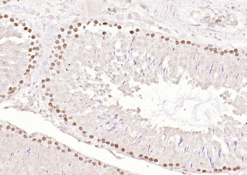 Islet-1 Rabbit Polyclonal Antibody
