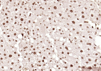 Islet-1 Rabbit Polyclonal Antibody