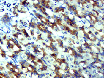 CCL5/RANTES Rabbit Polyclonal Antibody