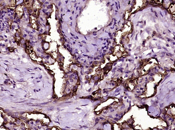 ICAM1/CD54 Mouse Monoclonal Antibody