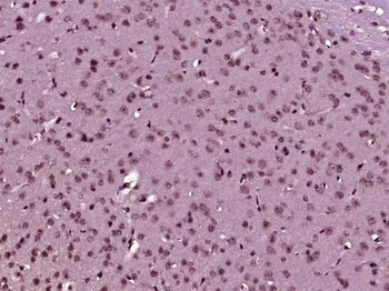 ERG/KCNH2 Rabbit Polyclonal Antibody