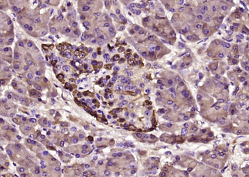 TTR/Prealbumin Mouse Monoclonal Antibody