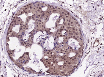 CDKN2A/p16-INK4a Rabbit Polyclonal Antibody