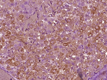 LHR Rabbit Polyclonal Antibody